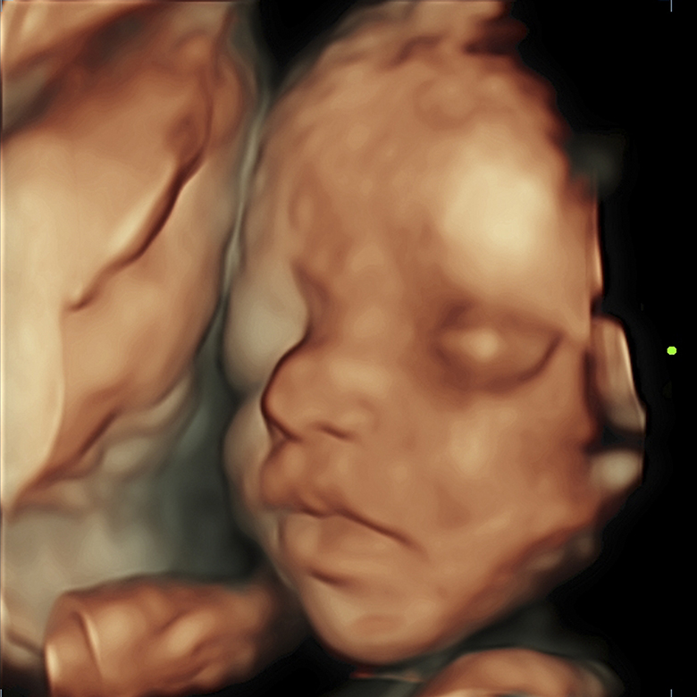 Patologia fetale e Gravidanza a rischio - ALTAMEDICA