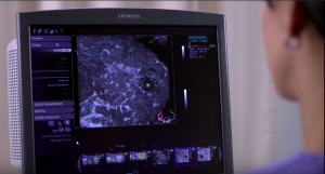 ecografia mammaria robotica 3D - risultati