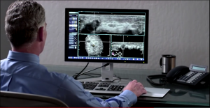 ecografia mammaria robotica 3D - imaging